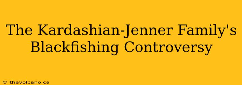 The Kardashian-Jenner Family's Blackfishing Controversy