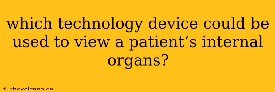 which technology device could be used to view a patient’s internal organs?